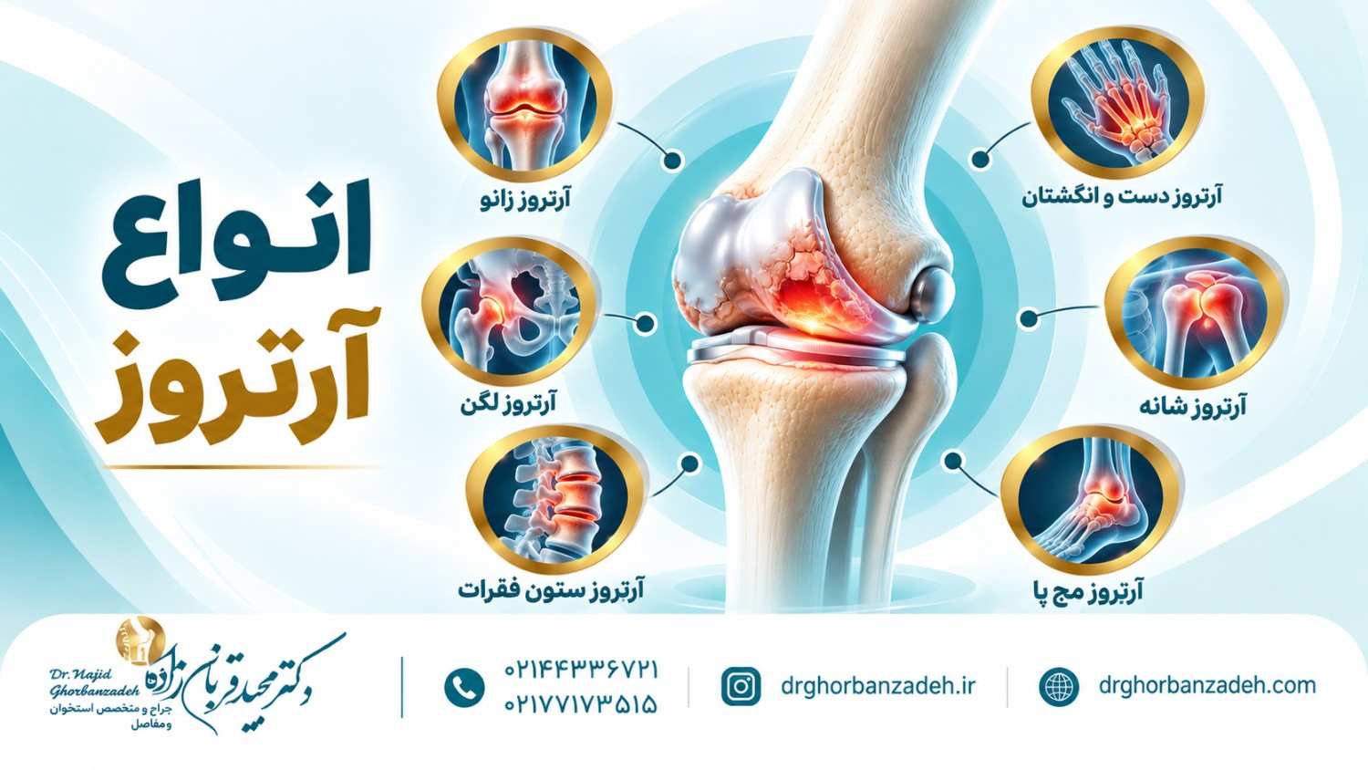 انواع آرتروز
