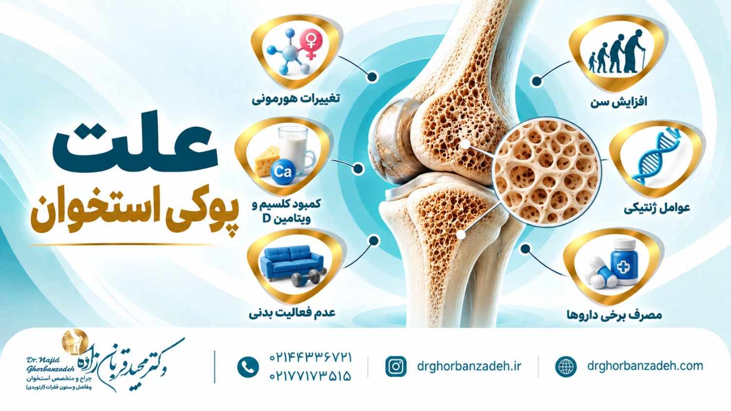 علت پوکی استخوان