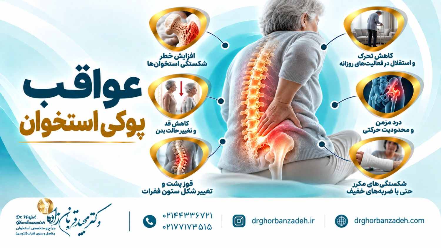 عواقب پوکی استخوان