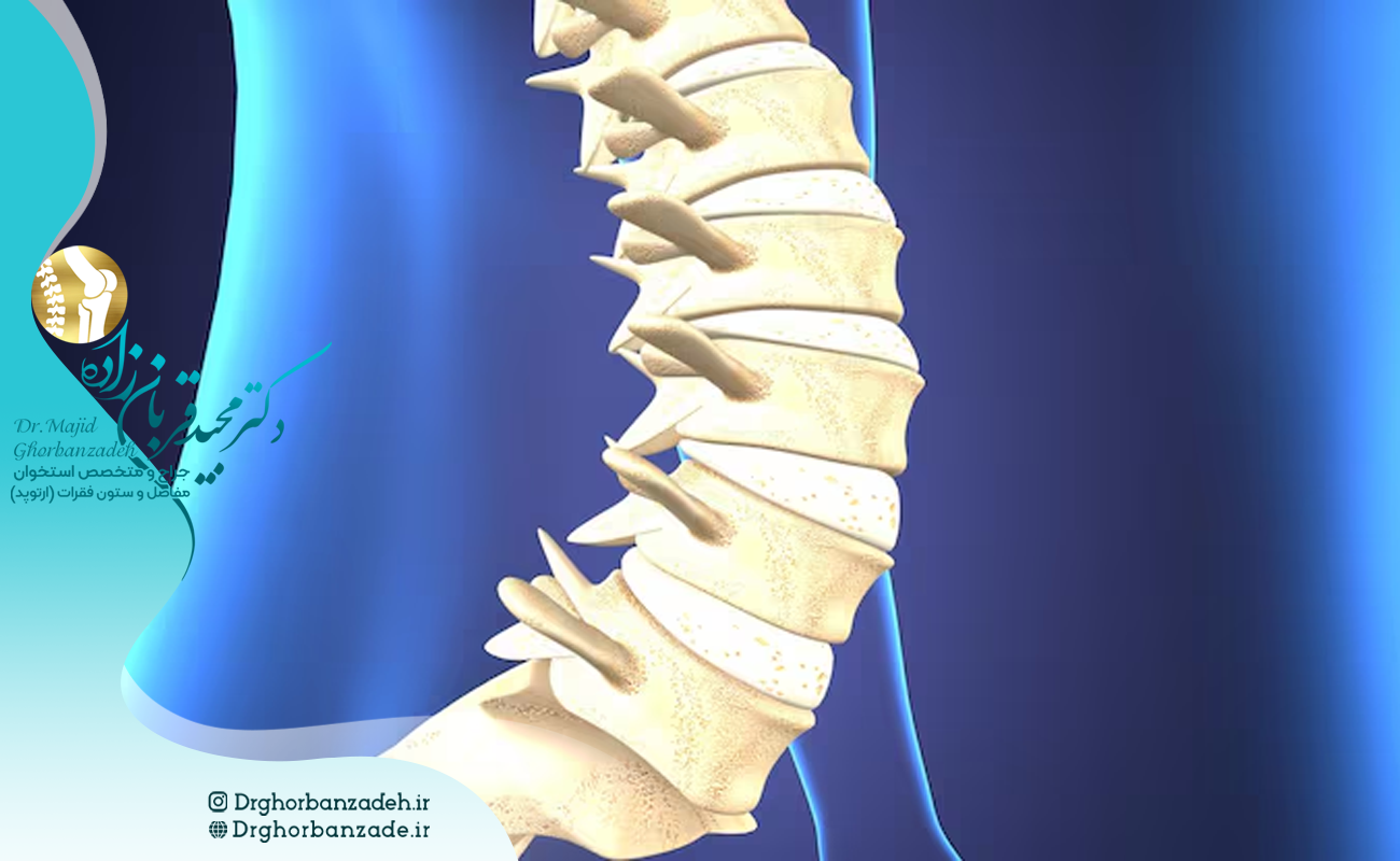 درمان تنگی کانال نخاعی