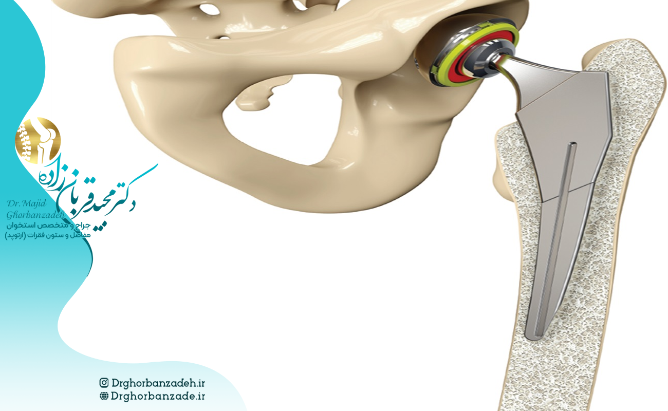 آسیب های ناشی از تصادفات