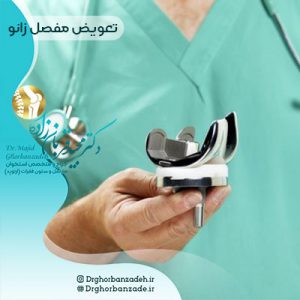 تعویض مفصل زانو