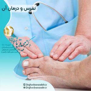 درمان نقرس چیست؟