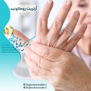 آرتریت روماتوئید