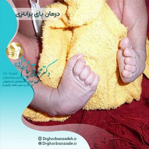 پای پرانتزی