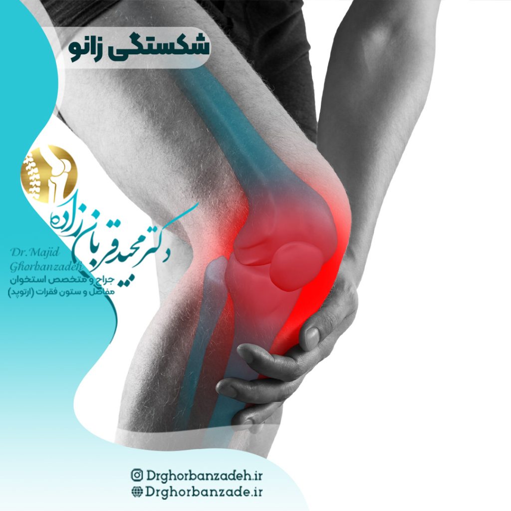 شکستگی مفصل زانو