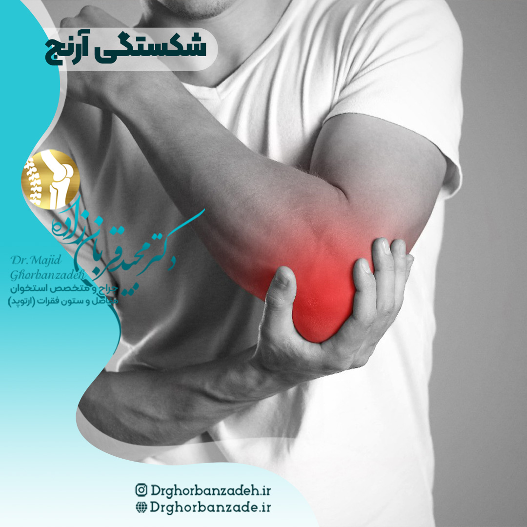 شکستگی آرنج