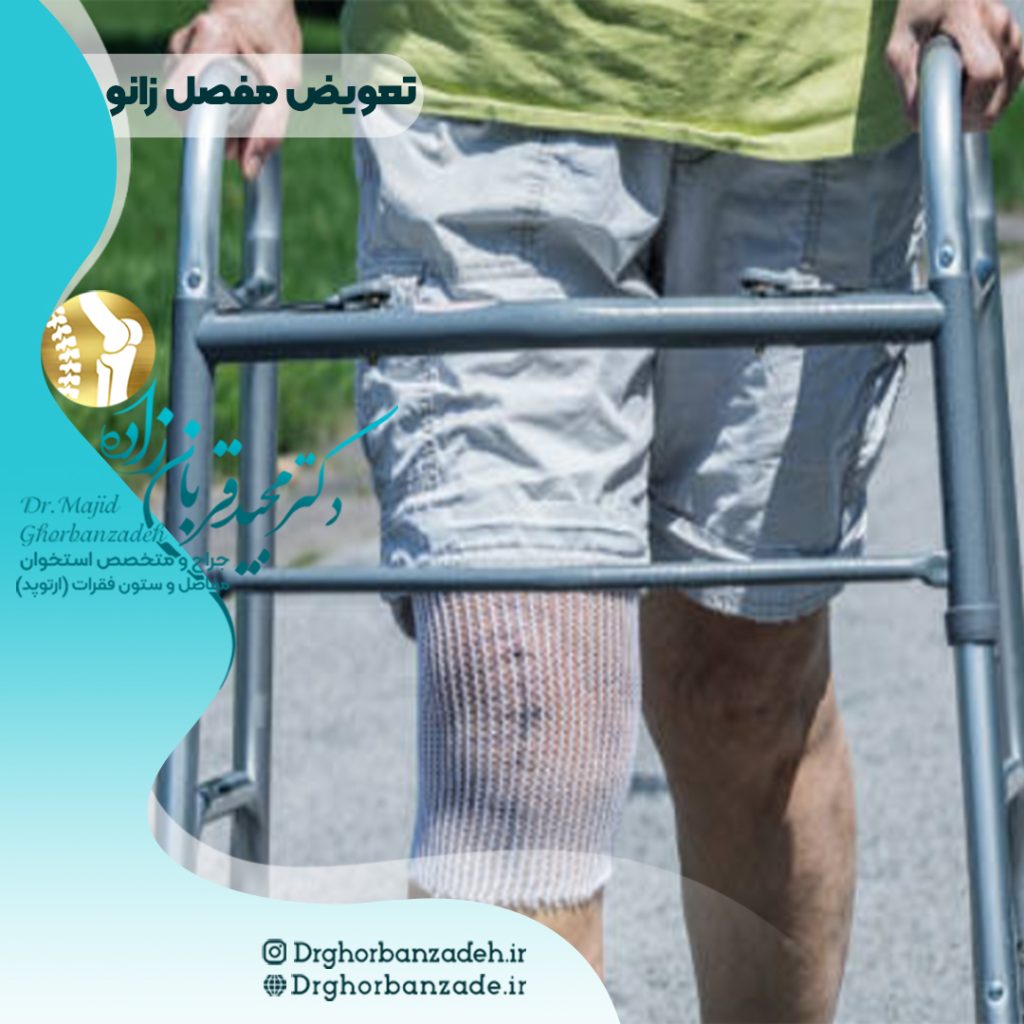 تعویض مفصل زانو در سالمندان