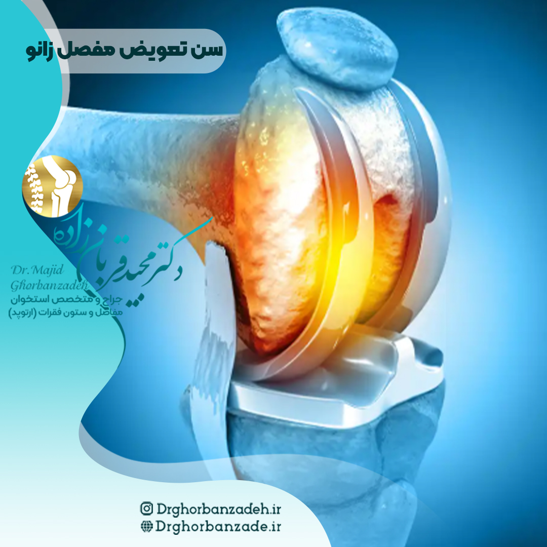 سن مناسب تعویض مفصل زانو